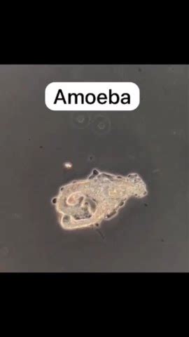  Jingle Bell Amoeba: A Microscopic Marvel that Crawls, Glides, and Feasts!