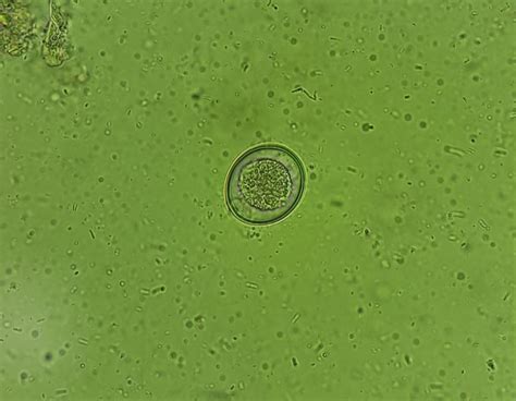  Oococcidia: สิ่งมีชีวิตตัวจิ๋วที่ซ่อนอยู่ในร่างผู้เป็นเจ้าบ้าน!