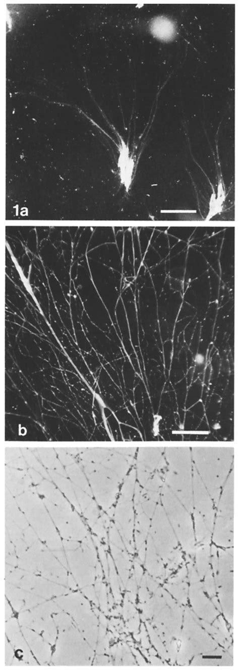  Reticulomyxa - A Masterful Sculptor of Microscopic Worlds!