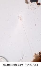  Vorticella! A Microscopic Master of Whipping Motion With a Delectable Appetite for Bacteria