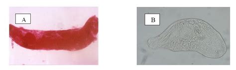  Xiphidiocercaria! หนอนตัวแบนที่อาศัยอยู่ในปอดของหอยและมีความฝันอยากเป็นปลาน้อย